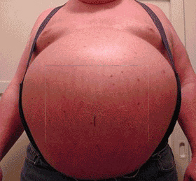 fat-belly-01.jpg